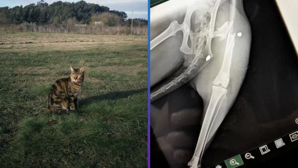 Vera y su fémur fracturado