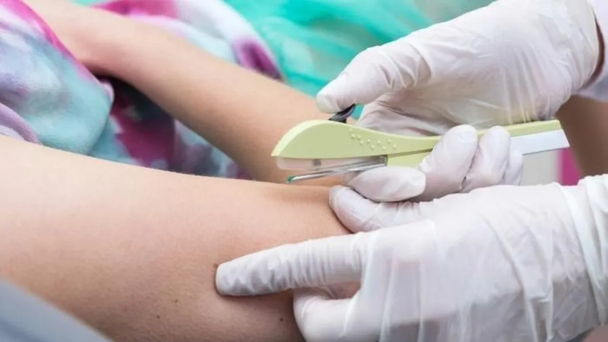 Colocación dde chip en jornada de salud